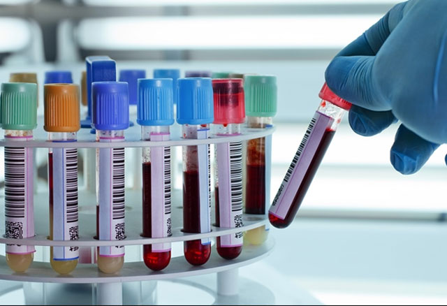 Casaletto Ceredano: riprende il servizio prelievi